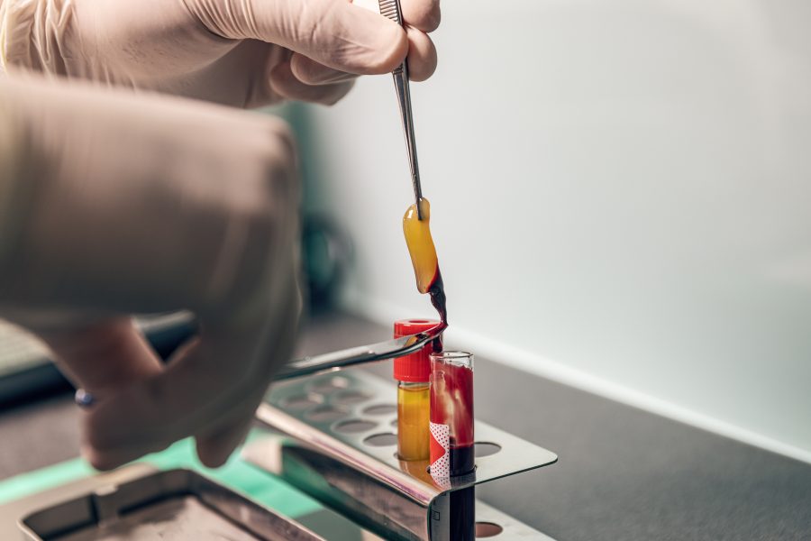 enxerto ósseo dentário com membrana