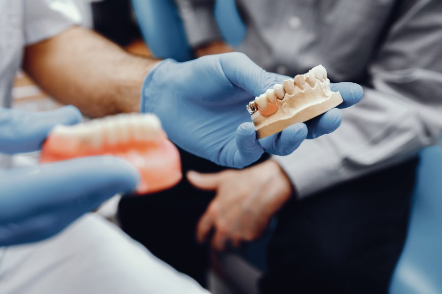 Quanto tempo dura um implante dentário