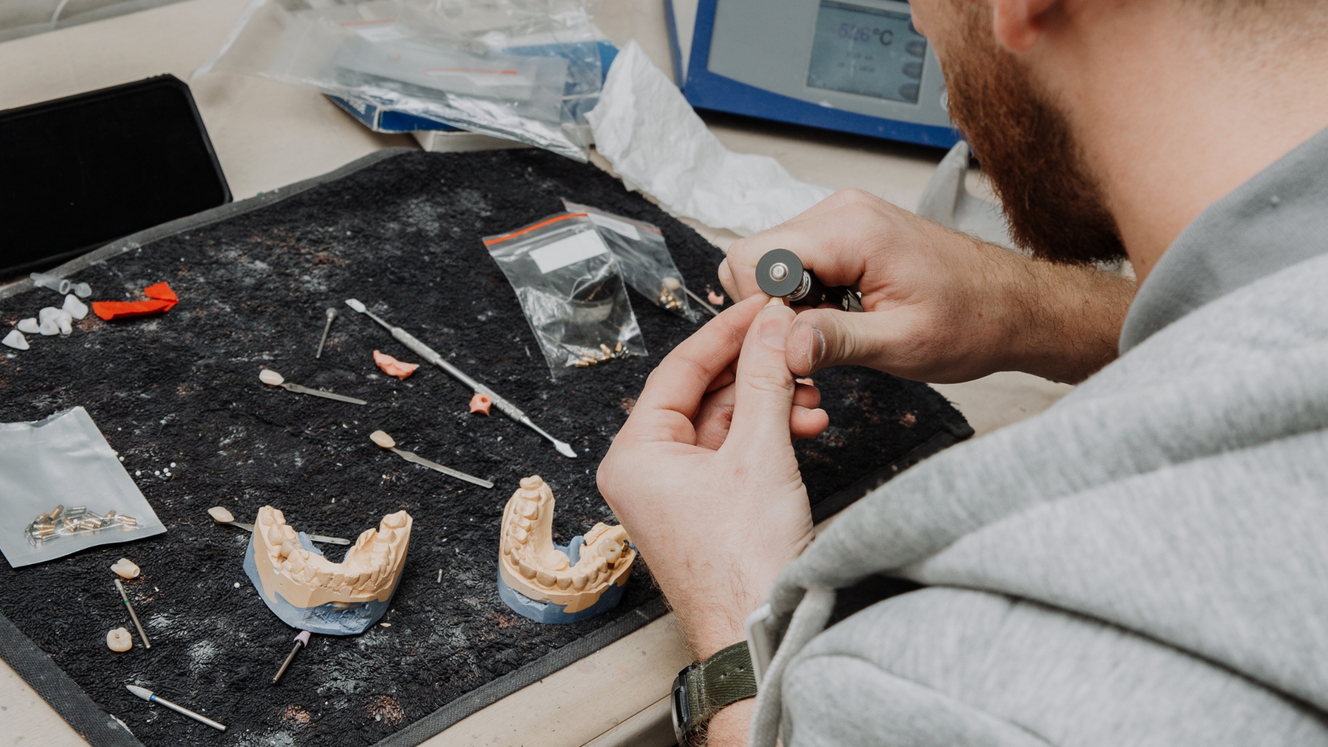 Quais são os tipos de implantes dentários?
