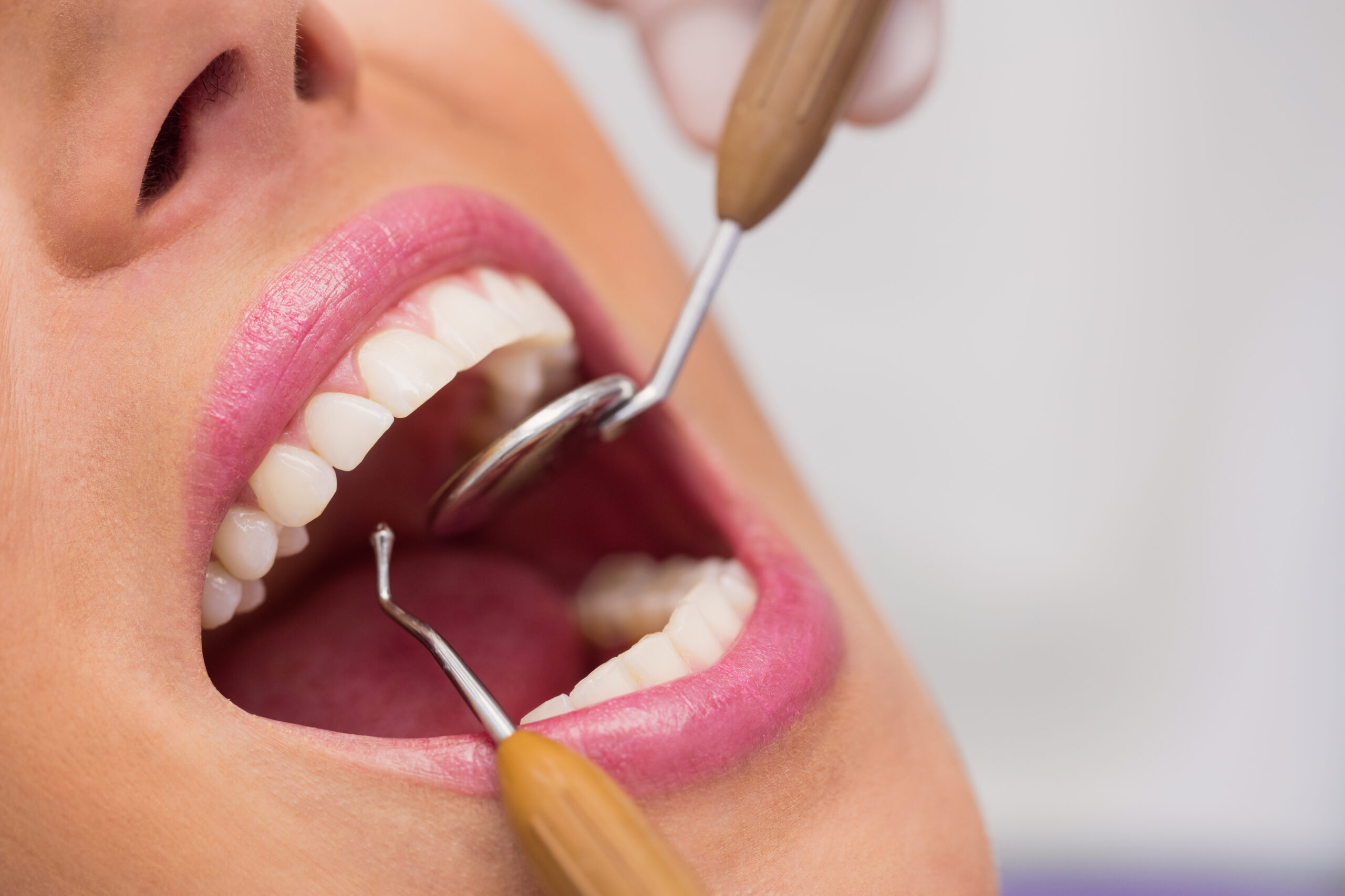 procedimento odontológico na gengiva da paciente