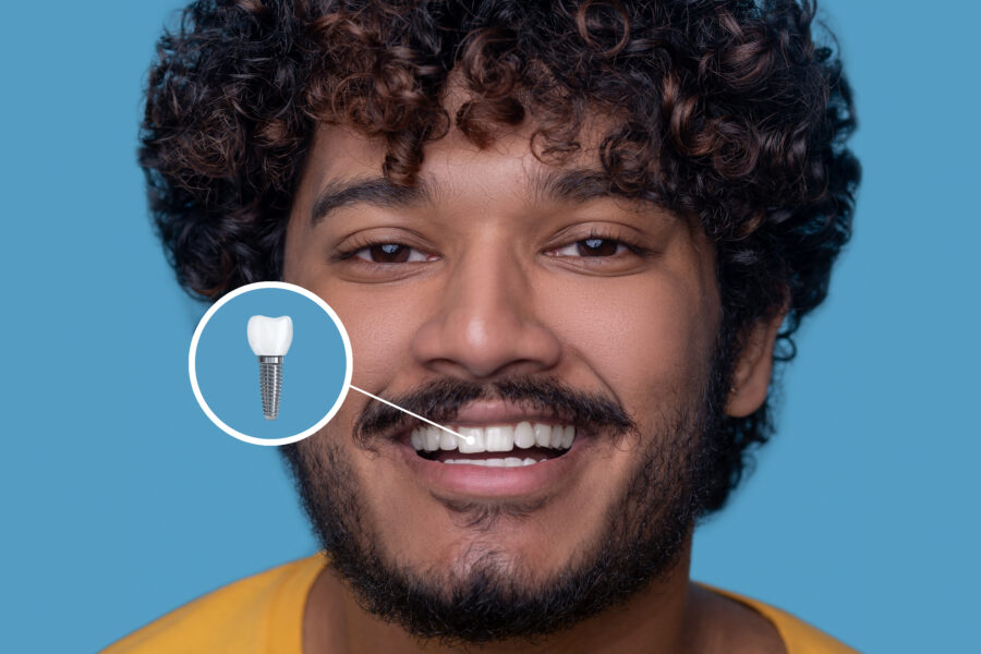 homem jovem com implante dentário