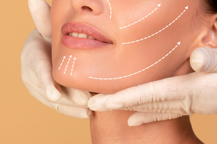 harmonização facial em rosto feminino