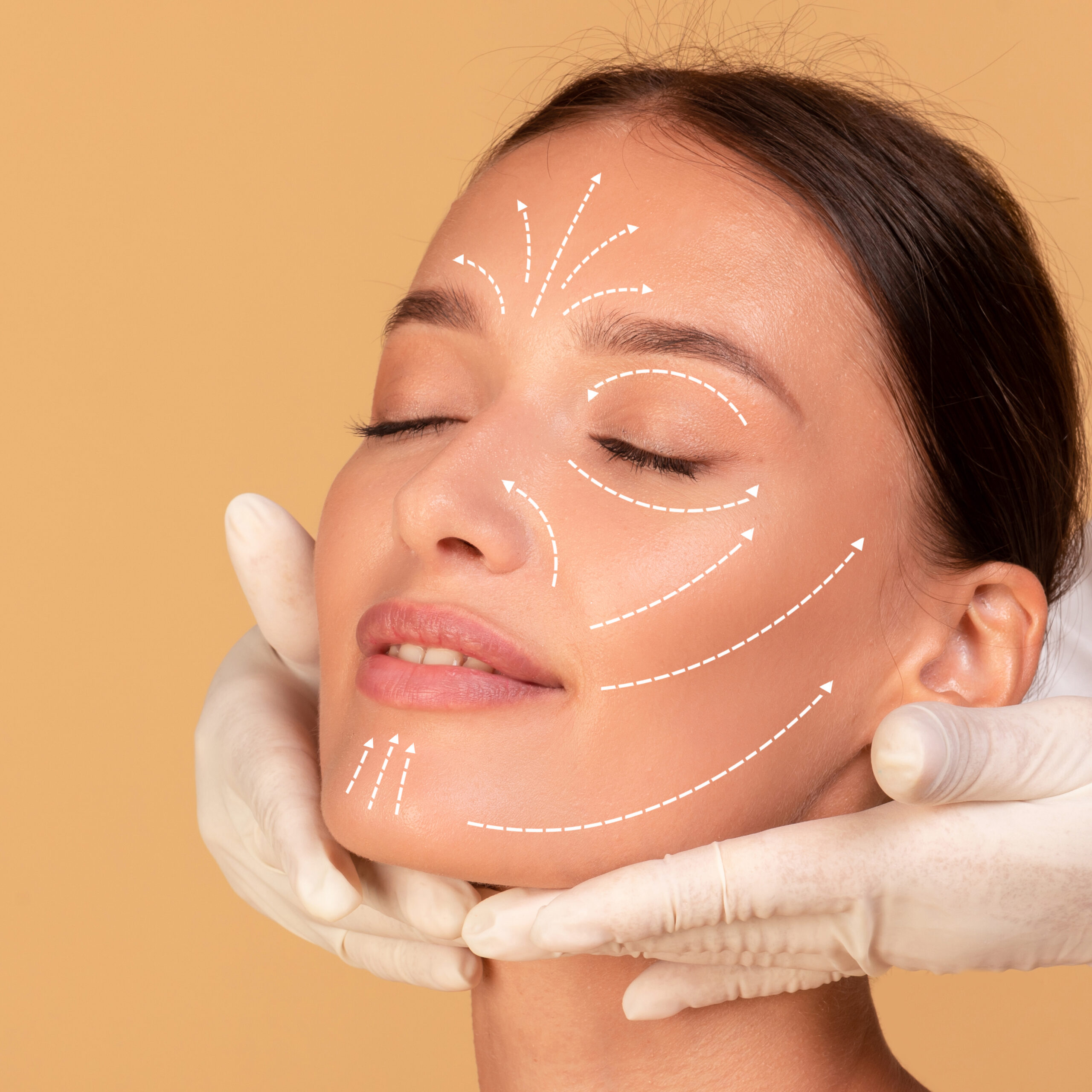 harmonização facial em rosto feminino