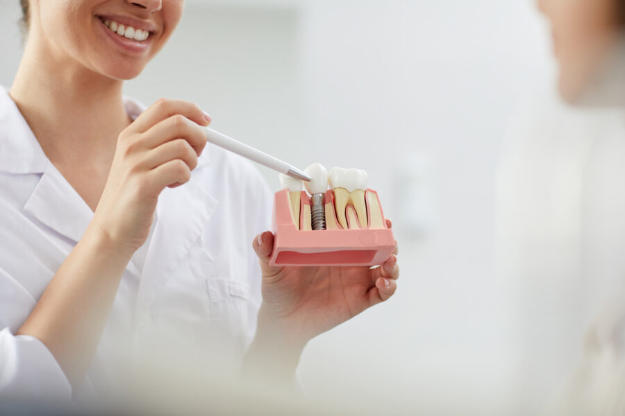 Dentista sorridente explicando a implantação do dente