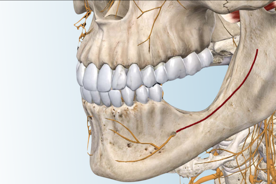 imagem demonstrativa do nervo alveolar inferior