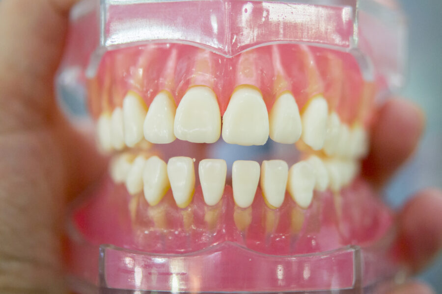 modelo de dentes humanos do close-up da mandíbula humana