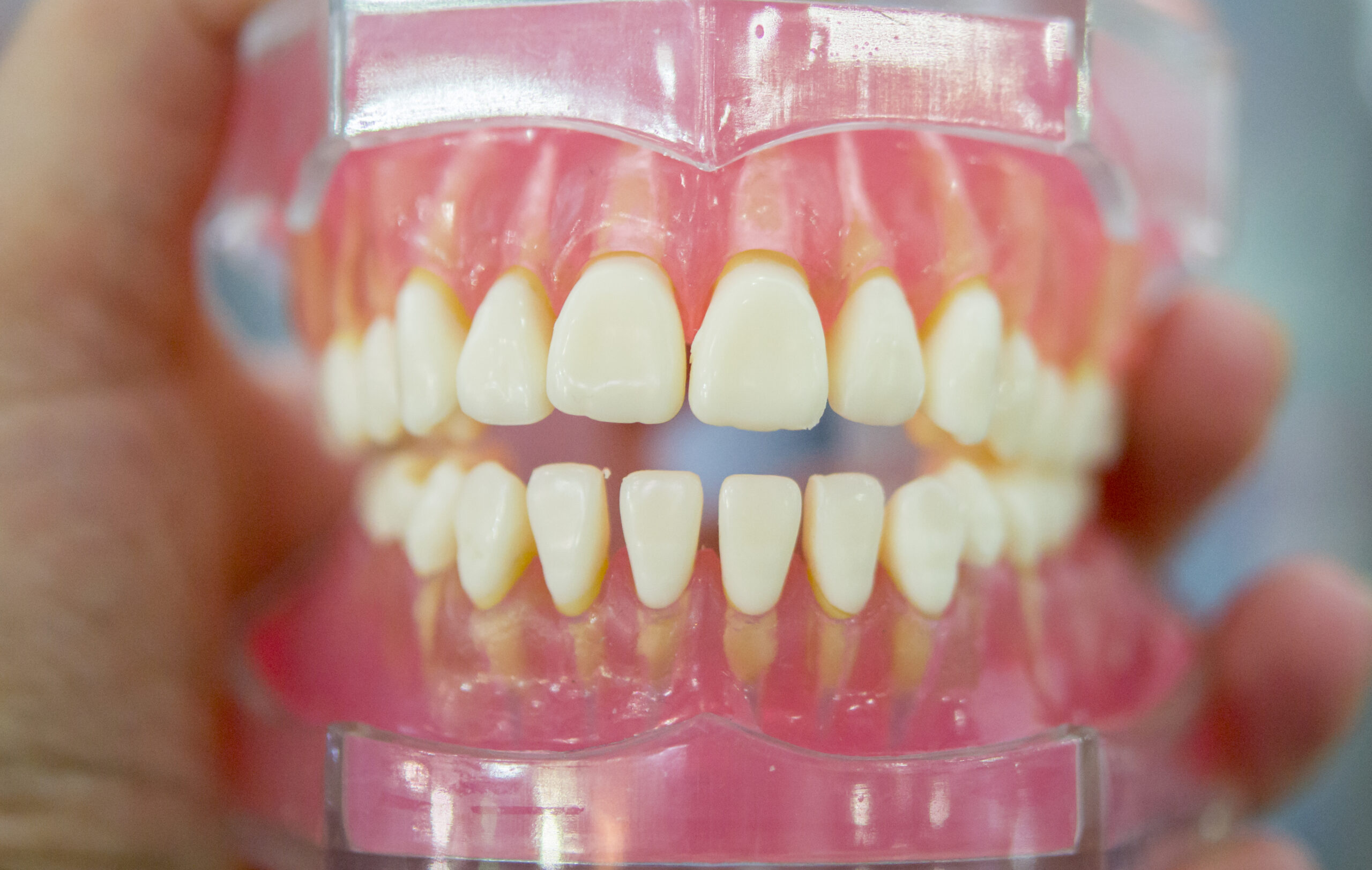 modelo de dentes humanos do close-up da mandíbula humana