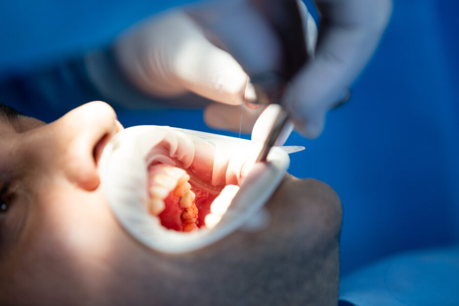 paciente em clinica dental durante operação