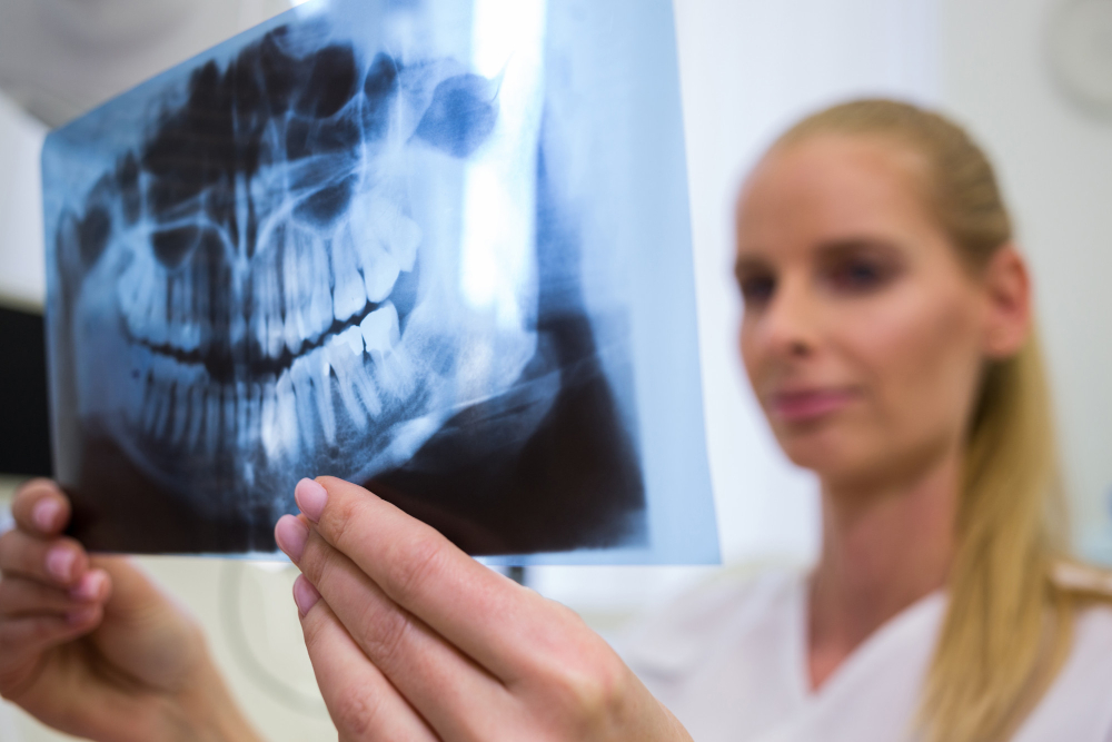 consolidação óssea: dentista olhando para placa de raio x dental