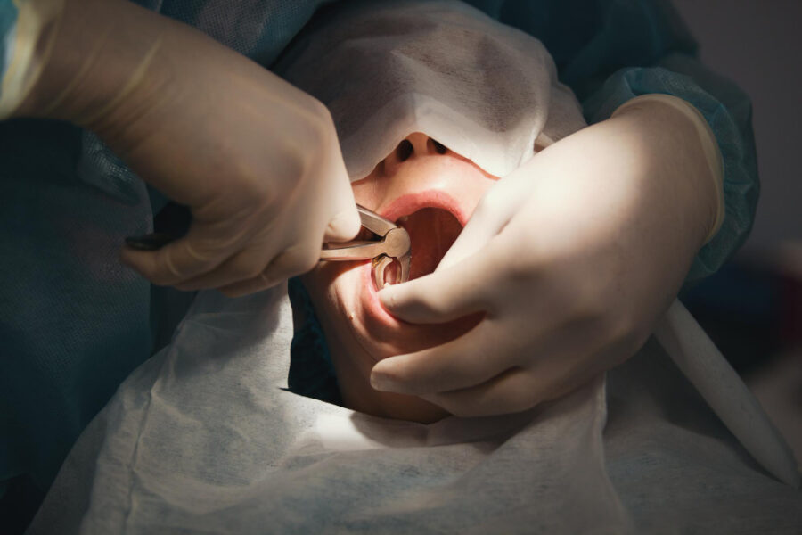 cirurgia parendodôntica