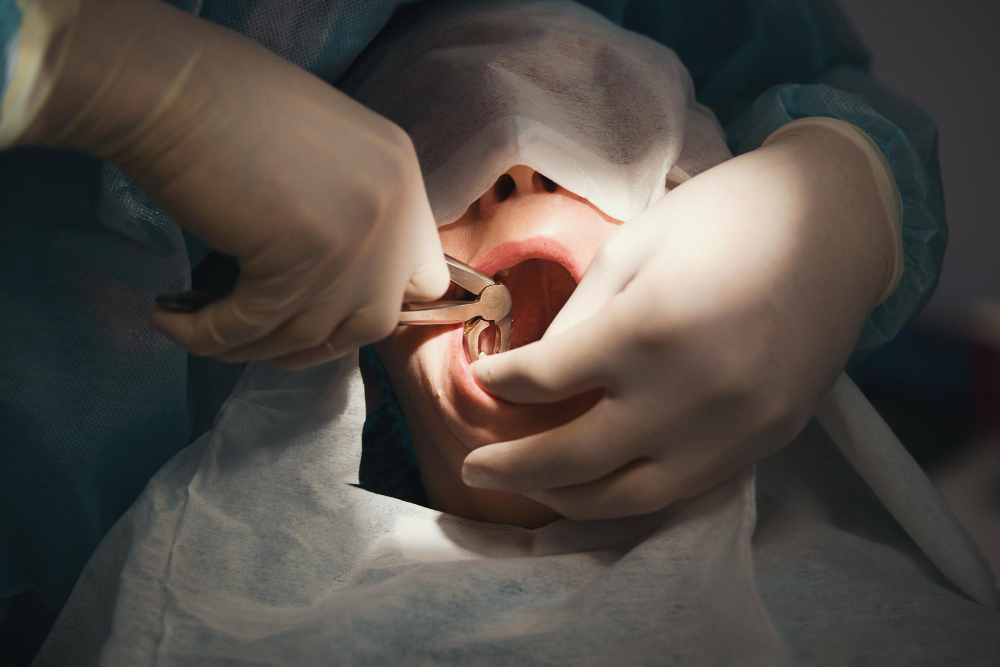 cirurgia parendodôntica