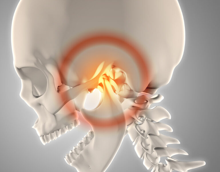 acidentes anatomicos da mandibula